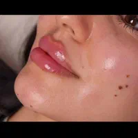 کاشت مو و کاشت ابرو وتزریق ژل و بوتاکس و مزو|خدمات آرایشگری و زیبایی|بهبهان, |دیوار