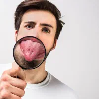 تشخیص بیماری ها از روی زبان رایگان