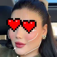 عمل بینی ۲۵ تومن فقط برای جمعه بیمارستان تاپ
