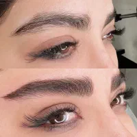 میکرو و فیبروز تخصصی ۵۰٪تخفیف ویژه تا پایان هفته