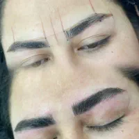 میکروبلیدینگ