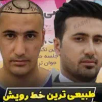 کاشت موکاشت ابرو+ اموزش کاشت مو نقد، اقساط تضمینی|خدمات آرایشگری و زیبایی|شیراز, عفیف‌آباد|دیوار