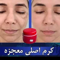 کرم سوپر معجزه صدرصد اصلی و ضمانتی|آرایشی، بهداشتی، درمانی|سنندج, |دیوار
