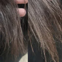 موخوره گیری واصلاح تخصصی ابرو