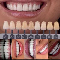 دندانپزشکی قسطی در مطب لنگرود