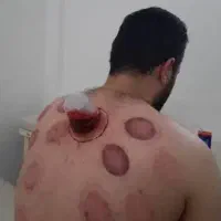 دکتر برای همکاری مرکز حجامت