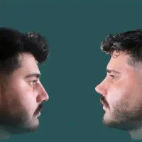 عمل بینی/پلک/غبغب/پیکرتراشی/دندونپزشکی