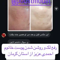 کرم زد لک 8کاره لاکچری کوین|آرایشی، بهداشتی، درمانی|برازجان, |دیوار