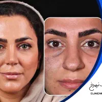 آخرین مهلت عمل بینی|خدمات آرایشگری و زیبایی|تهران, نظامی گنجوی (توانیر)|دیوار