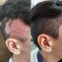 مانند آب خوردن ریشاتو درش بیار