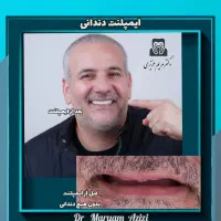 آفر پاییزی، عصبکشی تخصصی دندان پزشکی، زیر تعرفه|خدمات زیبایی و سلامت|شیراز, ملاصدرا|دیوار