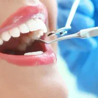 استخدام دستیار دندانپزشک