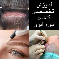 آموزش کاشت مو و ابرو