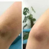 روشن کننده تخصصی بیوممتیک (روشن کننده فوری)