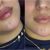 ژل لب|خدمات آرایشگری و زیبایی|شیراز, کوشک میدان|دیوار