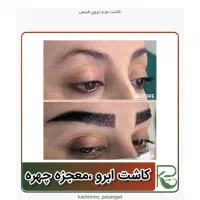 کاشت مو ابرو ریش تارکوب|خدمات آرایشگری و زیبایی|فردیس, شهرک وحدت|دیوار