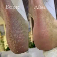 پدیکور و کفسابی پا با ۴۰ درصد تخفیف