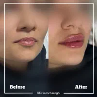 جشنواره پاییزی تخفیفات زیبایی توسط پزشک|خدمات آرایشگری و زیبایی|کرمانشاه, |دیوار