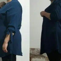 چربیسوزی طبیعی
