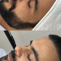 رسیدگی به پوست با مشاوره تخصصی پزشک