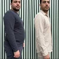 کاهش وزن و لاغری سریع بدون افتادگی پوست
