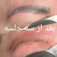 لیزر پاک کردن تتو بشکل مدرن|خدمات آرایشگری و زیبایی|اهواز, فرهنگ شهر|دیوار
