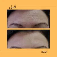 خدمات زیبایی در کلینیک ماهورا|خدمات آرایشگری و زیبایی|بندرعباس, |دیوار