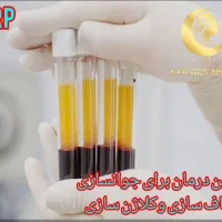 خدمات پاکسازی پوست،میکرونیدیلینگ، پلکسرواسیدتراپی