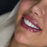 هلی کلینیک هر واحد کامپوزیت 800هزارتومان|خدمات آرایشگری و زیبایی|ایلام, |دیوار