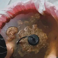 ماساژ رگ گیری سیاتیک سمزدایی جااندازی ناف تول گیری|خدمات زیبایی و سلامت|کرمانشاه, |دیوار
