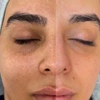 فیشال تخصصی