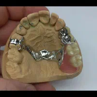 دست دندان  5 میلیون