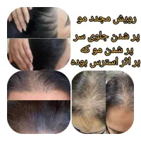 روغن تقویت و رشد مجدد مو|خوردنی و آشامیدنی|تهران, نارمک جنوبی|دیوار