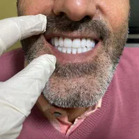 دندان مصنوعی لبخند (ضمانت ۱۰ ساله/تحویل ۳تا ۷ روز)|خدمات آرایشگری و زیبایی|کرج, اصفهانیها|دیوار