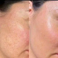 پوست و زیبایی