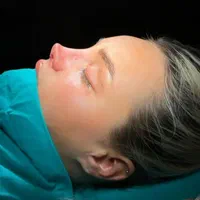 جراحی و عمل زیبایی بینی ( رینو پلاستی )|خدمات آرایشگری و زیبایی|کرج, گوهردشت|دیوار