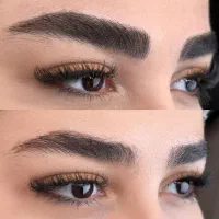 میکروبلیدینگ کرکی مویی