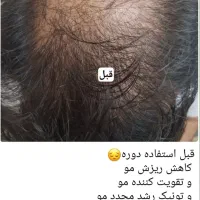 میخوای محصولی بهت معرفی کنم موههاتو تقویت کنه