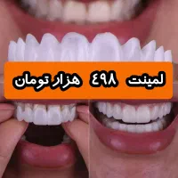 واوهوLl(اصل)