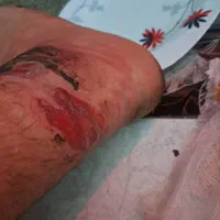 طب سنتی گیاهی ،،بهرامی