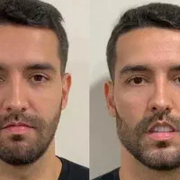 فیرها بوتاکس و چربی پیشرفته اقایون