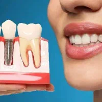 ثبت نام بیمه دندانپزشکی و کامپوزیت طلایی شو|خدمات آرایشگری و زیبایی|گرگان, |دیوار