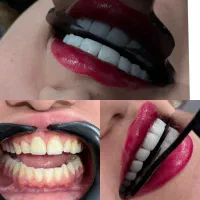 کامپوزیت دندان با برندهای معتبر جهانی|خدمات آرایشگری و زیبایی|اهواز, نادری|دیوار