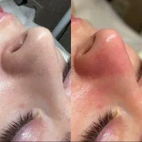 پاکسازی تخصصی  پوست|خدمات آرایشگری و زیبایی|دهدشت, |دیوار