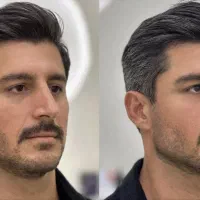 جشنواره تزریق ژل لب فیلر بادی مزو مادلینگ بوتاکس|خدمات زیبایی و سلامت|تهران, صادقیه|دیوار