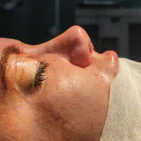 زیبایی بینی۲۹تومن با متخصص گوش و حلق و بینی|خدمات آرایشگری و زیبایی|ورامین, ورامین|دیوار