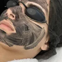 کربن تراپی پیلینگ هالیوودی روشن سازی نواحی تیره