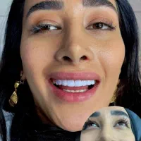 زیبایی دندان