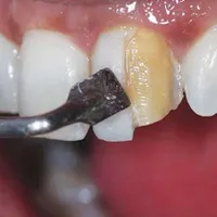 جشنواره شگفتی مطب دندانپزشکی|خدمات آرایشگری و زیبایی|مشهد, احمدآباد|دیوار