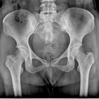 رادیولوژی در منزل آلارا|خدمات آرایشگری و زیبایی|مشهد, احمدآباد|دیوار